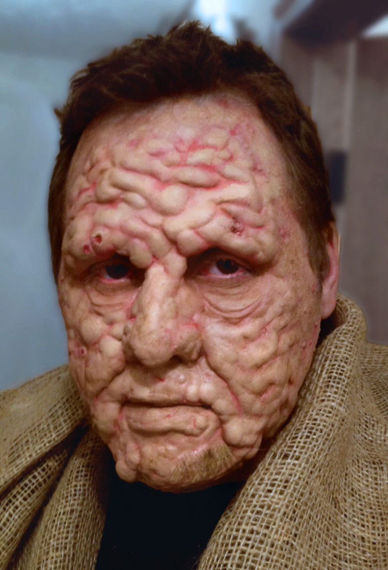 10 Scariest Diseases In The World - Elite Facts